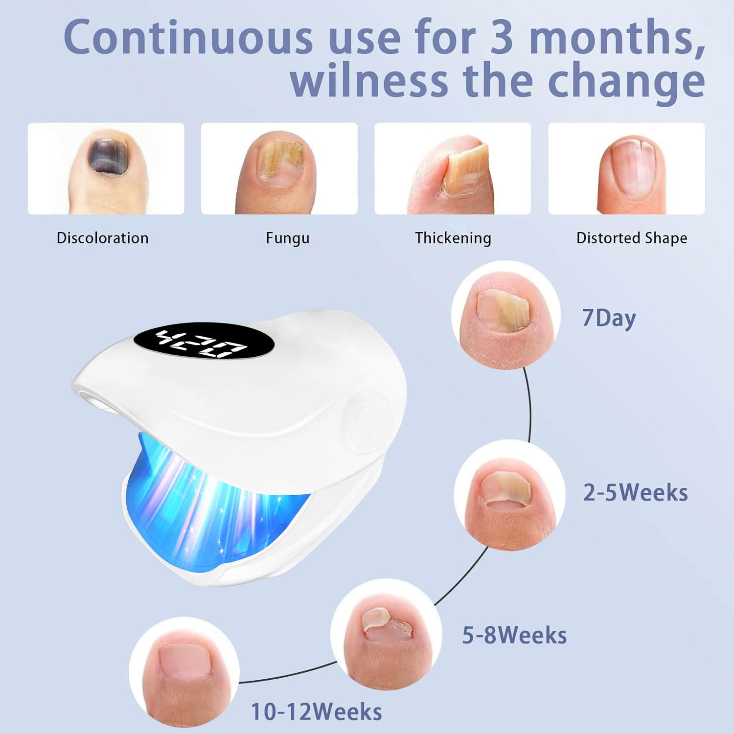 Lámpara de Fototerapia Láser p - Industrial Laser Removal reseña y precio